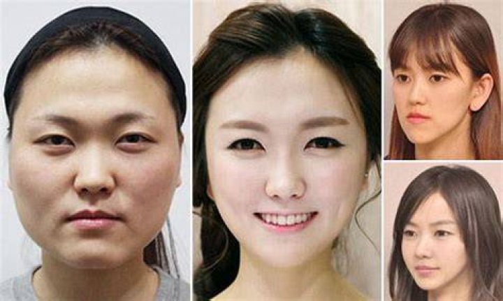 50 Korean Plastic Surgery Before and After Photos Forbidden Knowledge TV