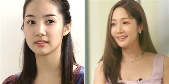 After Surgery Park Min-young
