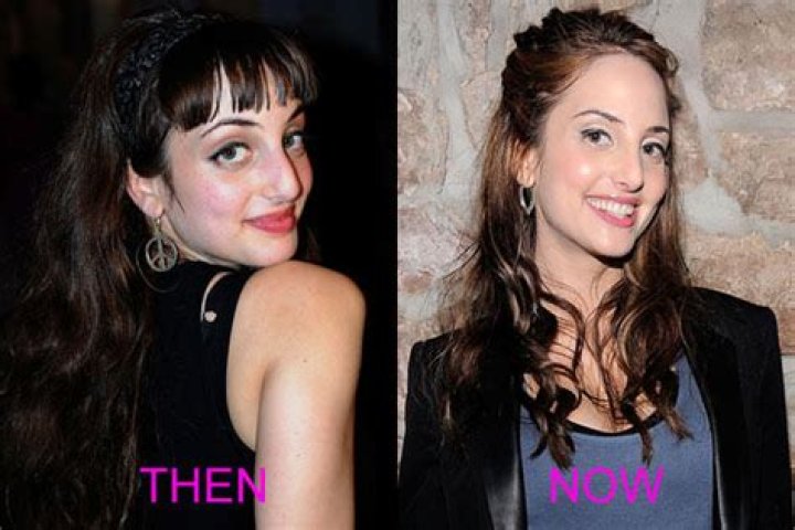 Alexa Ray Joel plastic surgery (24) Celebrity plastic surgery online