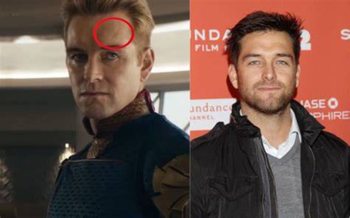 Antony Starr Forehead