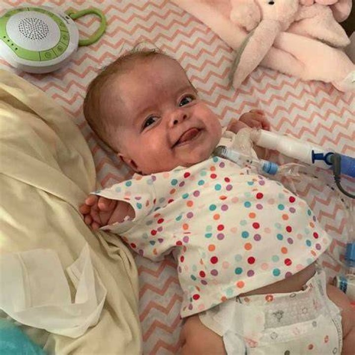 Baby with rare dwarfism is home after 184 days in hospital ABC News