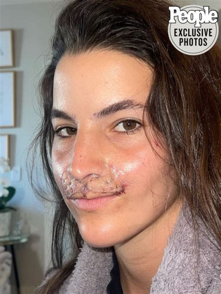 Brooklinn Khoury Recalls Being 'Scared' of How She Looked After Dog Attack