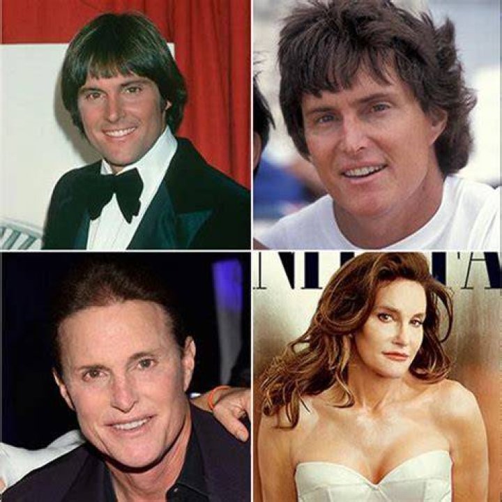 Capturing The Evolution: Pictures Of Caitlyn Jenner