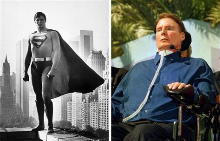 Christopher Reeve Doppelganger: Striking Similarities Uncovered