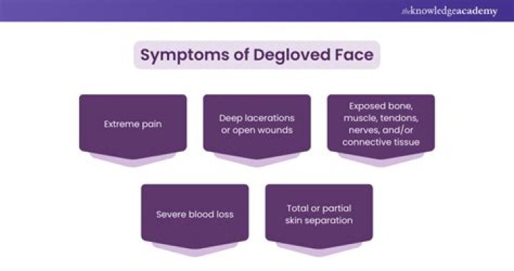 degloved face Technical Masterminds