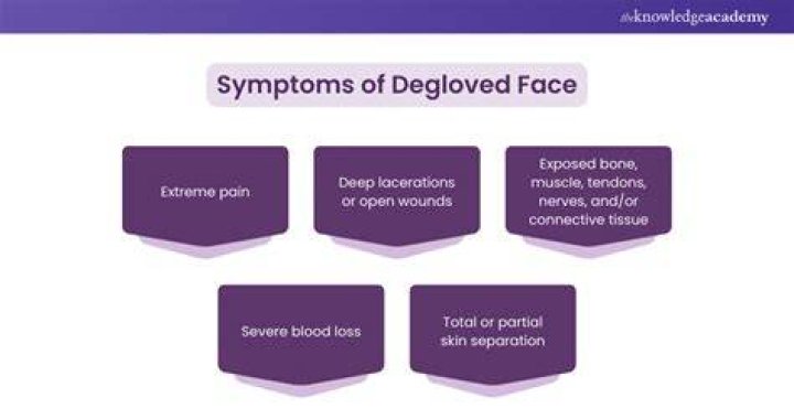 Degloved Face Video Gallery (Sorted by Views) Know Your Meme