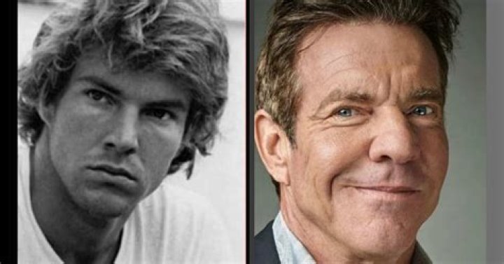 dennis quaid plastic surgery Archives Plastic Surgery Facts
