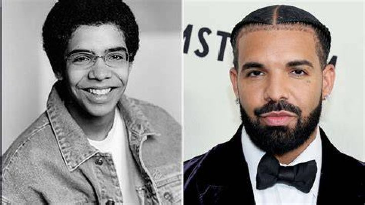 Did Drake Get a Nose Job Plastic Surgery?