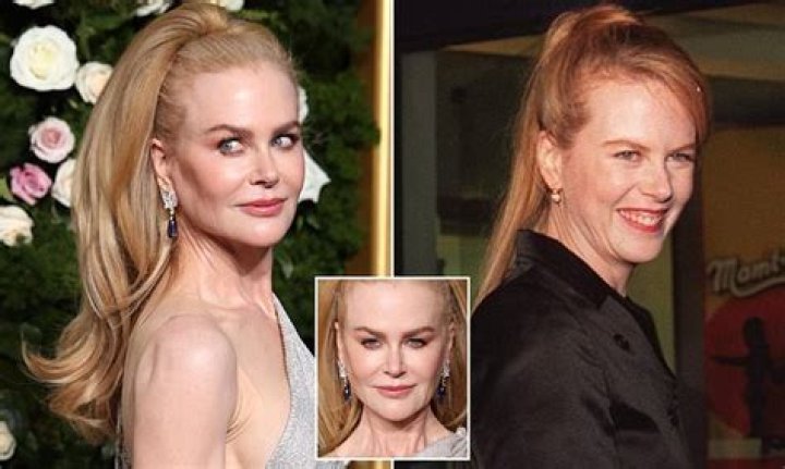 Did Nicole Kidman Have Plastic Surgery? See Transformation