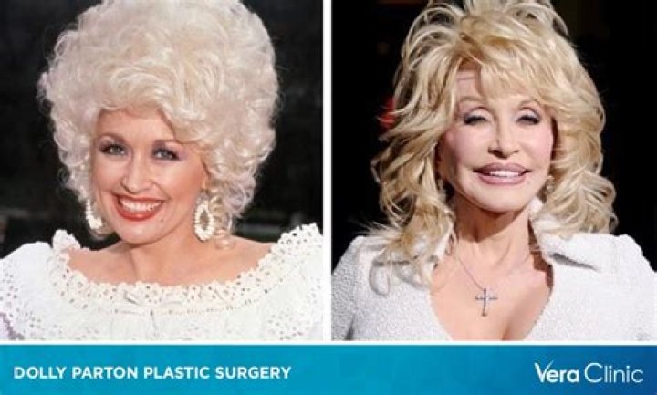 Dolly Parton Plastic Surgery 6 Times the Star Talked About Her Past