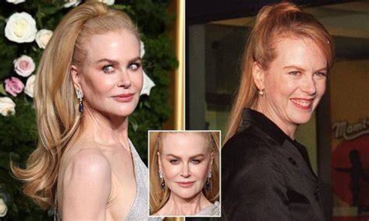 Has Nicole Kidman Had Plastic Surgery? The Actress's Face Has Been