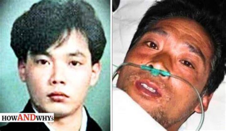 Hisashi Ouchi was kept alive for 83 days after absorbing 17 Sieverts of