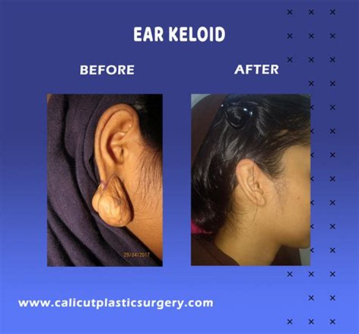 Karlie Redd: The Transformation Before Surgery