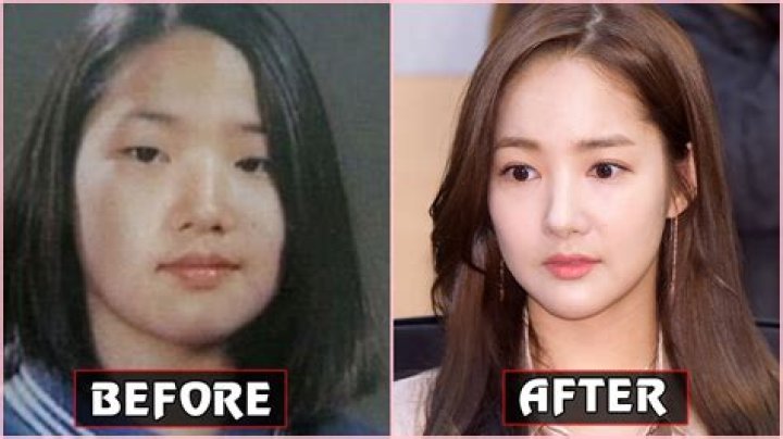 Korean Actress Plastic Surgery All In One Photos My XXX Hot Girl