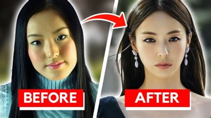 Korean Actresses Plastic Surgery Before And After Pic vrogue.co
