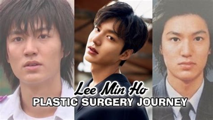 Lee Min Ho Plastic Surgery plastic surgery helped lee min ho the