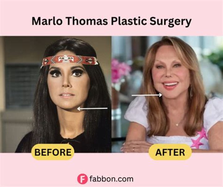 Marlo Thomas Plastic Surgery Diversity News Magazine