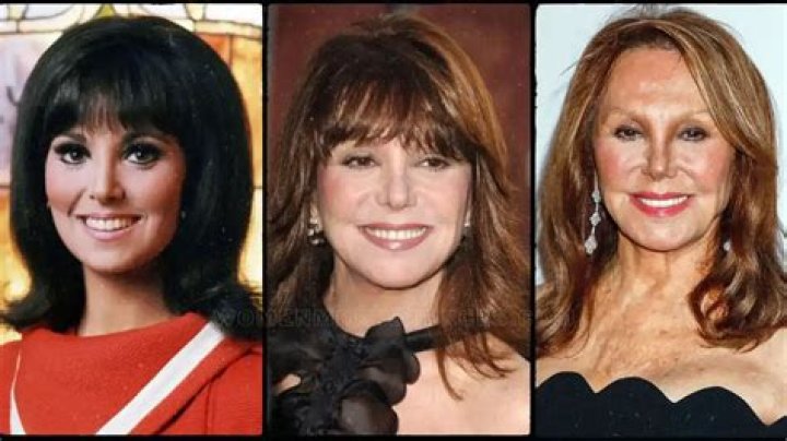 Marlo Thomas Plastic Surgery Facelift, Eyelid Surgery, Teeth Veneer