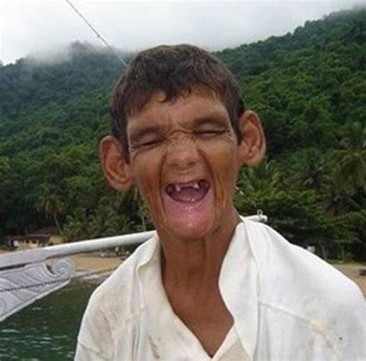 Most Ugly People In The World (28 Images) Ugliest people Scary
