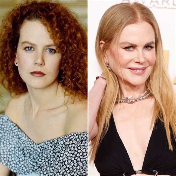 Nicole Kidman Addressed Plastic Surgery and Botox Rumors After Dramatic