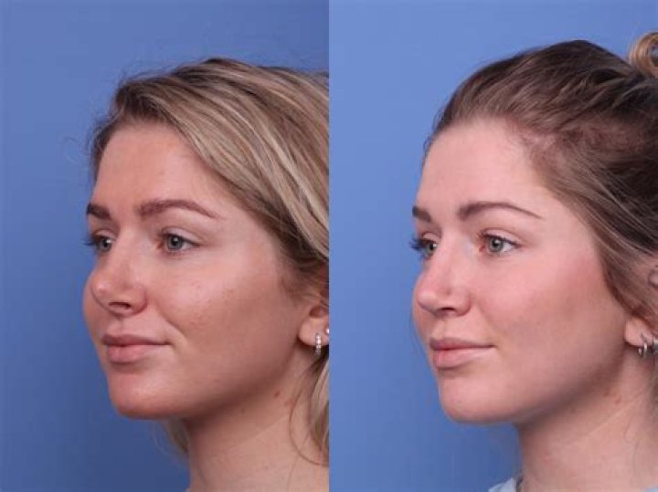 Pin auf Plastic Surgery Before and After