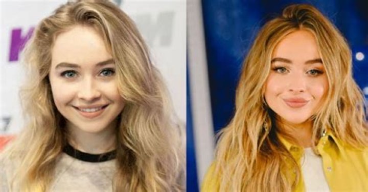 Sabrina Carpenter Plastic Surgery The Truth Behind Her Stunning Looks!