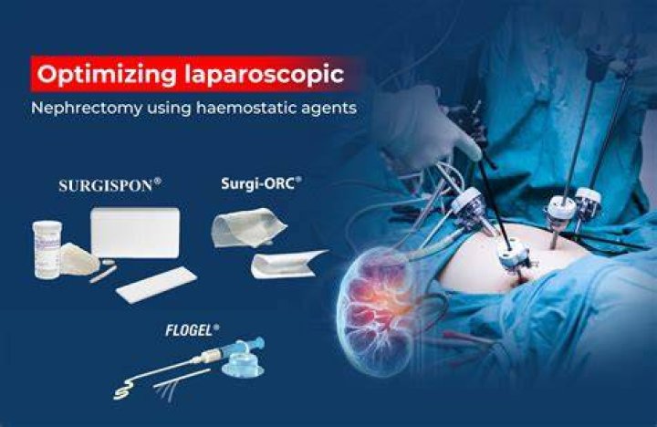 Surgical Advances in Laparoscopic Donor Nephrectomy IntechOpen