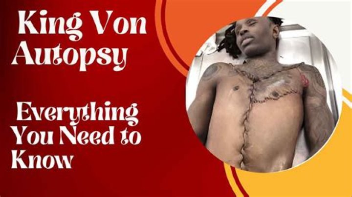 The Comprehensive Guide To Ling Von Autopsy
