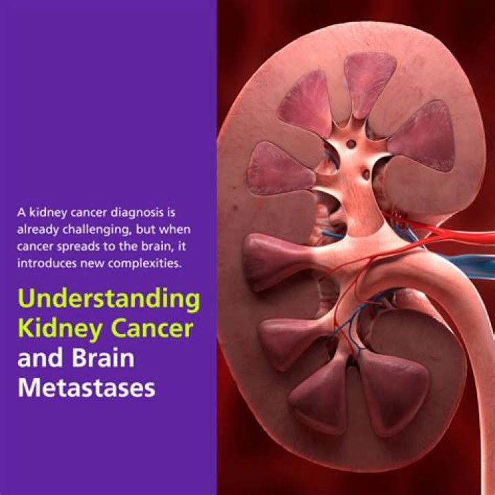 Understanding The Aftermath: Kidney Removal Scarring