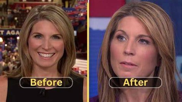 Unveiling The Truth: Nicole Wallace And Her Journey Through Plastic Surgery