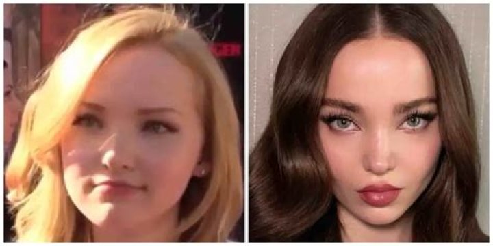Why did Dove Cameron change her name? Celebrity.fm 1 Official