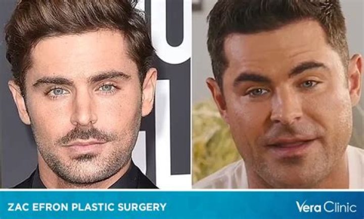 Zac Efron debunks plastic surgery rumors